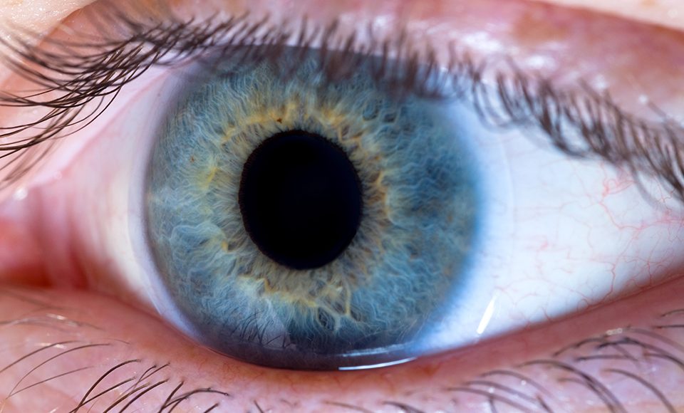 LENTES DE CONTATO